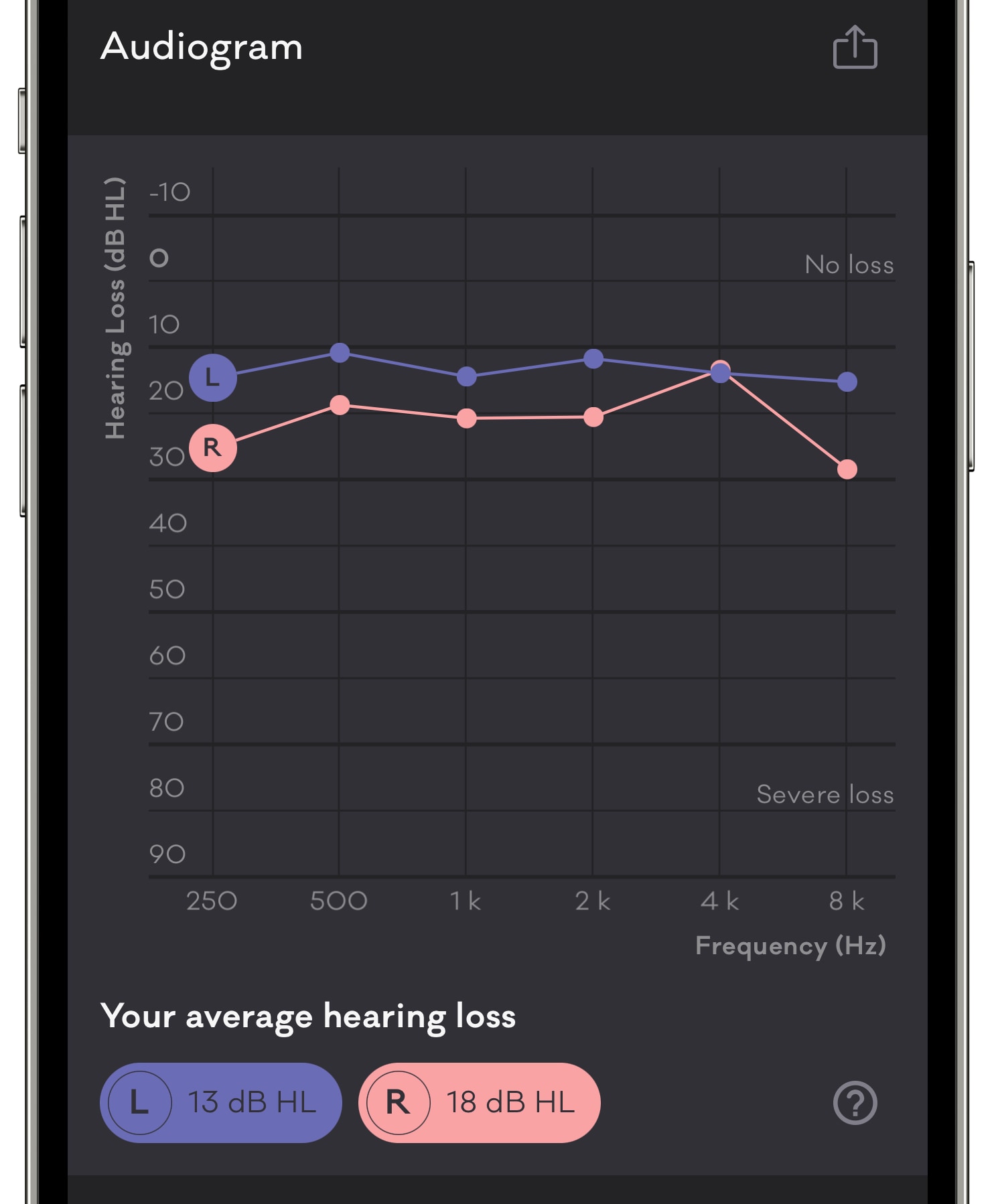 iPhone screenshot showing the summary screen in the Mimi Hearing Test app after taking a pure audio threshold hearing test