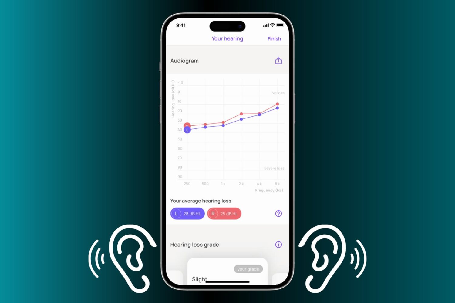 Audiogram on iPhone