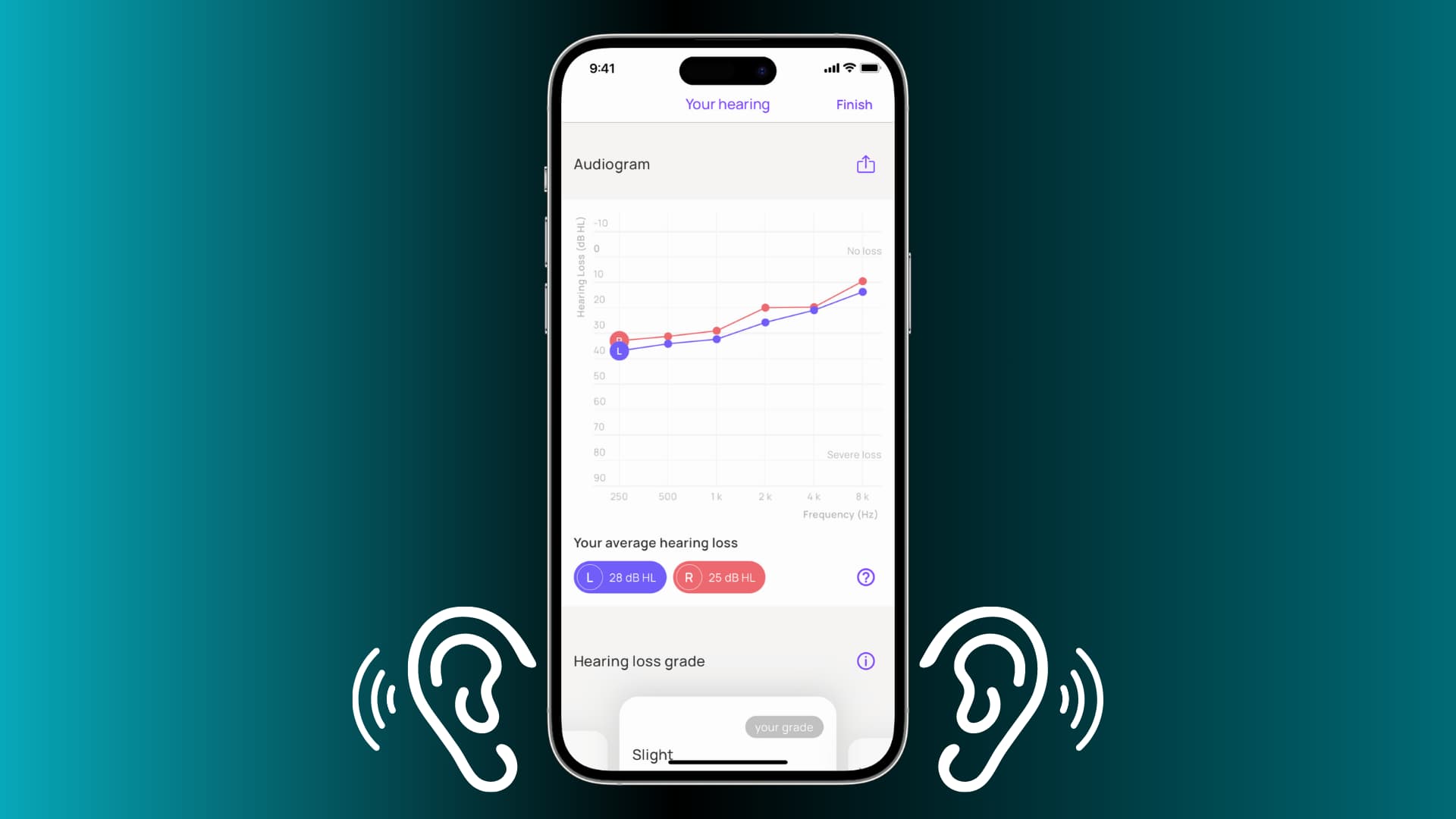 Audiogram on iPhone