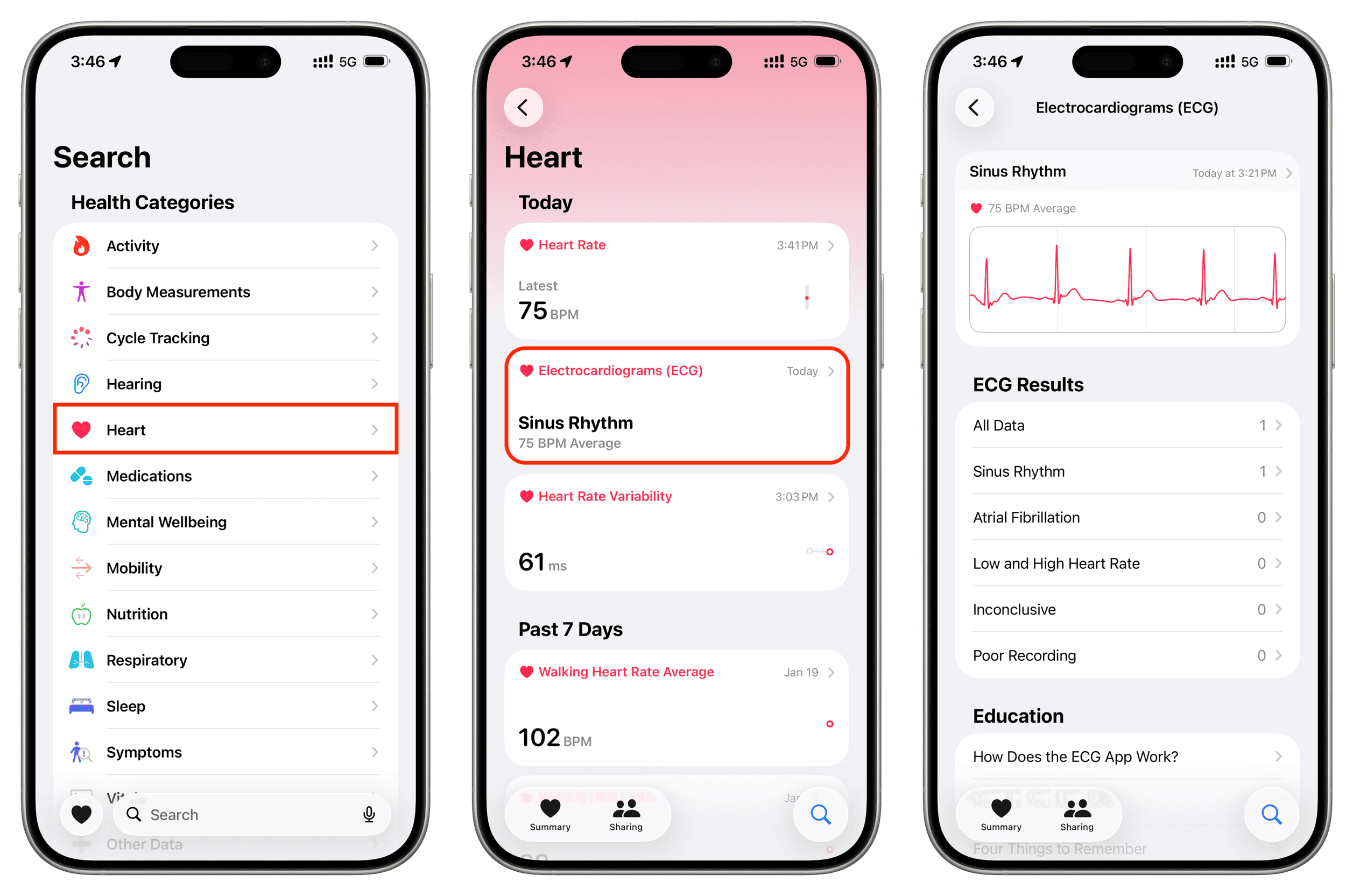 How to take an ECG on your Apple Watch